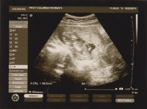 ultrasound 2014-10-23 1.jpg